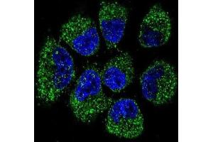 Immunofluorescence (IF) image for anti-Tumor Necrosis Factor Receptor Superfamily, Member 11b (TNFRSF11B) antibody (ABIN2997504)