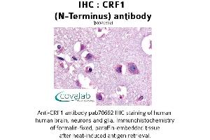Image no. 1 for anti-Corticotropin Releasing Hormone Receptor 1 (CRHR1) (Extracellular Domain), (N-Term) antibody (ABIN1733304) (CRHR1 anticorps  (Extracellular Domain, N-Term))