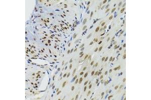 Immunohistochemistry of paraffin-embedded mouse stomach using BAZ1B antibody.