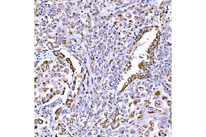 IHC analysis of SUCLG1 using anti-SUCLG1 antibody (ABIN7600906). (SUCLG1 anticorps  (AA 25-346))