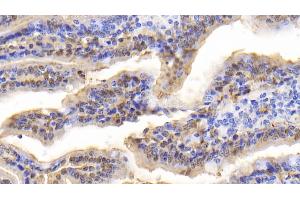 Detection of FABP2 in Bovine Small intestine Tissue using Polyclonal Antibody to Fatty Acid Binding Protein 2, Intestinal (FABP2) (FABP2 anticorps  (AA 2-128))