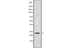 Western blot analysis of RAB24 using Jurkat whole cell lysates