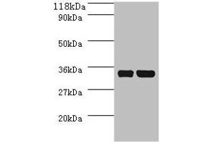 Western blot All lanes: dcyD antibody at 2 μg/mL + DH5a whole cell lysate Secondary Goat polyclonal to rabbit IgG at 1/10000 dilution Predicted band size: 35 kDa Observed band size: 35 kDa (DcyD anticorps  (AA 2-328))