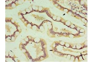 Immunohistochemistry of paraffin-embedded human small intestine tissue using ABIN7156912 at dilution of 1:100 (IL-37 anticorps  (AA 1-218))