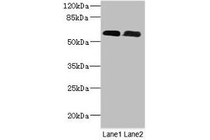 Western Blot All lanes: PNPLA1 antibody at 12 μg/mL Lane 1: Mouse spleen tissue Lane 2: Mouse skeletal muscle tissue Secondary Goat polyclonal to rabbit IgG at 1/10000 dilution Predicted band size: 58, 48, 49 kDa Observed band size: 58 kDa (PNPLA1 anticorps  (AA 101-300))