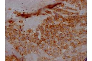 IHC image of ABIN7127316 diluted at 1:100 and staining in paraffin-embedded human placenta tissue performed on a Leica BondTM system.