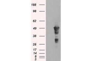 Image no. 1 for anti-Glial Fibrillary Acidic Protein (GFAP) antibody (ABIN1498442) (GFAP anticorps)