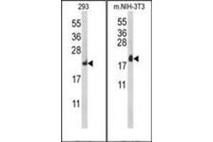 Western blot analysis of RPL18A Antibody (C-term) Cat. (RPL18A anticorps  (C-Term))