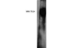 Image no. 1 for anti-Lipid Phosphate Phosphatase-Related Protein Type 3 (LPPR3) antibody (ABIN229307)