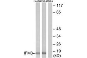 Western blot analysis of extracts from HepG2/HeLa cells, using IFM3 Antibody. (IFITM3 anticorps  (AA 1-50))