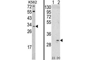 (LEFT) Western blot analysis of ITM2A Antibody (N-term) in K562 cell line lysates (35ug/lane). (ITM2A anticorps  (N-Term))