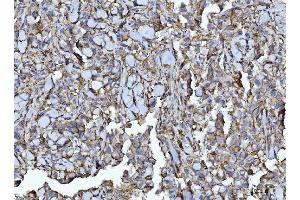 IHC analysis of CD147/Emmprin using anti-CD147/Emmprin antibody (ABIN7599999). (CD147 anticorps  (AA 138-323))