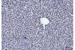 IHC analysis of Cathepsin B/CTSB using anti-Cathepsin B/CTSB antibody (ABIN7601692).