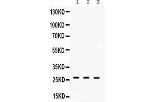 Western blot analysis of DDAH2 expression in rat lung extract ( Lane 1), mouse lung extract ( Lane 2) and human placenta extract ( Lane 3). (DDAH2 anticorps  (C-Term))
