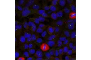 Image no. 1 for anti-Eukaryotic Translation Initiation Factor 4 Gamma, 1 (EIF4G1) (Ser1232) antibody (ABIN319387)