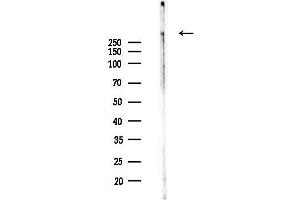 Western blot analysis of lysates from 293 cells(heat-shock,45 min treatment), using SRRM2 Antibody at 1/1000 dilution.