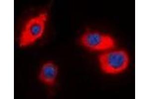 Immunofluorescent analysis of CIDEB staining in HT29 cells. (CIDEB anticorps)