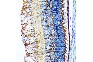 Immunohistochemistry of paraffin-embedded mouse retina using CRALBP Rabbit mAb (ABIN7269934) at dilution of 1:100 (40x lens).