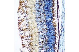 Immunohistochemistry of paraffin-embedded mouse retina using CRALBP Rabbit mAb (ABIN7269934) at dilution of 1:100 (40x lens). (RLBP1 anticorps)