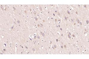 Detection of MOG in Human Cerebrum Tissue using Monoclonal Antibody to Myelin Oligodendrocyte Glycoprotein (MOG)