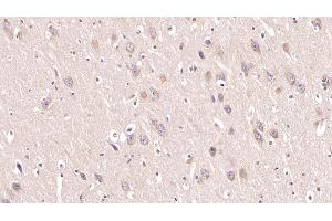 Detection of MOG in Human Cerebrum Tissue using Monoclonal Antibody to Myelin Oligodendrocyte Glycoprotein (MOG) (MOG anticorps  (AA 30-149))