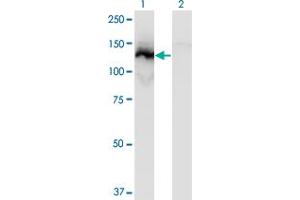 Western Blot analysis of SSH1 expression in transfected 293T cell line by SSH1 monoclonal antibody (M12), clone 2F9. (SSH1 anticorps  (AA 752-849))