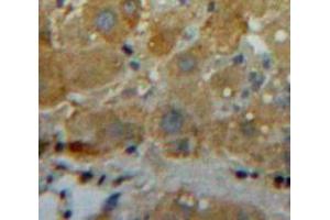 Used in DAB staining on fromalin fixed paraffin-embedded Liver tissue (Zinc Finger Protein CONSTANS-LIKE 9-Like (COL9) (AA 1572-1754) anticorps)