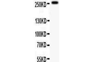 Anti-ABCA4 antibody, Western blotting All lanes: Anti ABCA4  at 0. (ABCA4 anticorps  (C-Term))