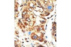 Image no. 1 for anti-Membrane Associated Guanylate Kinase, WW and PDZ Domain Containing 1 (MAGI1) (C-Term) antibody (ABIN360704)