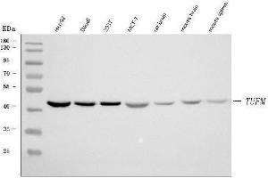 Western blot analysis of TUFM using anti-TUFM antibody (ABIN7602475).