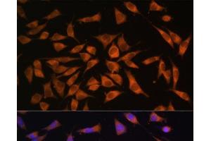 Immunofluorescence analysis of L929 cells using PMM2 Polyclonal Antibody at dilution of 1:100. (PMM2 anticorps)