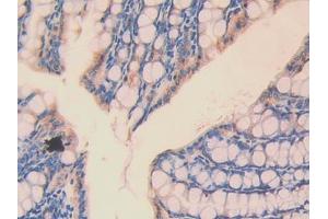 Used in DAB staining on fromalin fixed paraffin- embedded kidney tissue