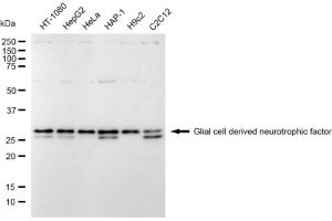 anti-Glial Cell Line Derived Neurotrophic Factor (GDNF) antibody