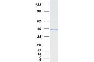 Validation with Western Blot