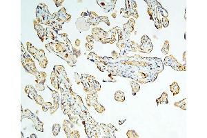 IHC analysis of Caspase-3 using anti-Caspase-3 antibody (ABIN6719555). (Caspase 3 anticorps  (AA 67-175))