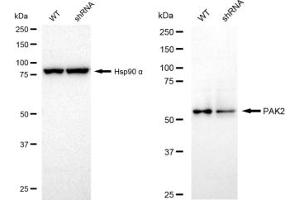 Western blotting analysis using PAK2 antibody (ABIN7799719). (Recombinant PAK2 anticorps)