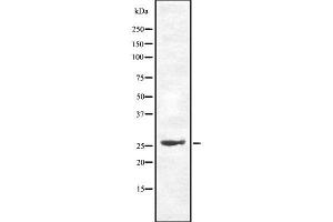 Western blot analysis of Cdc34 using HepG2 whole cell lysates (CDC34 anticorps  (Internal Region))
