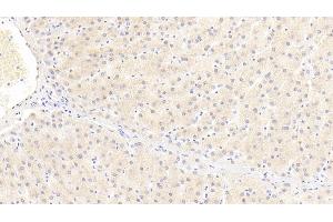 Detection of ITIH4 in Human Liver Tissue using Polyclonal Antibody to Inter Alpha-Globulin Inhibitor H4 (ITIH4)