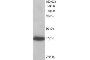 Western Blotting (WB) image for anti-PDZ and LIM Domain 4 (PDLIM4) (C-Term) antibody (ABIN2466091) (PDLIM4 anticorps  (C-Term))