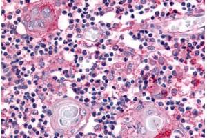 anti-Ubiquitin Specific Peptidase 4 (USP4) (Internal Region) antibody