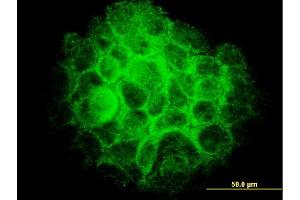 Immunofluorescence of monoclonal antibody to TRIB3 on A-431 cell.