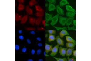 ABIN6257110 and ABIN6274624 staining Hela cells(45 min of heat-shock) by IF/ICC.