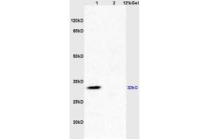 Lane 1: mouse brain lysates Lane 2: mouse kidney lysates probed with Anti SDHB Polyclonal Antibody, Unconjugated (ABIN719411) at 1:200 in 4 °C.