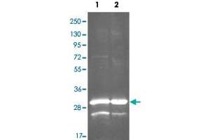 Western Blot analysis by gdh polyclonal antibody  at 1:3000.