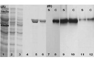 SDS–PAGE and Western blots that confirm LLO production by three of the constructed strains. (LLO anticorps)