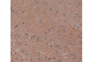 Used in DAB staining on fromalin fixed paraffin- embedded brain tissue (Tenascin R anticorps  (AA 329-588))