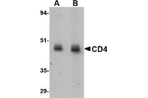 Western Blotting (WB) image for anti-CD4 (CD4) (N-Term) antibody (ABIN492544) (CD4 anticorps  (N-Term))