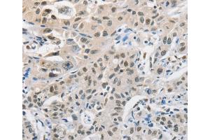 Immunohistochemistry (IHC) image for anti-Cell Division Cycle 27 Homolog (S. Cerevisiae) (CDC27) antibody (ABIN2427931) (CDC27 anticorps)