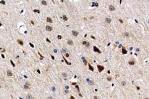 Immunohistochemistry analysis of paraffin-embedded rat brain using,SLC6A15 (ABIN7075681) at dilution of 1: 600 (SLC6A15 anticorps)