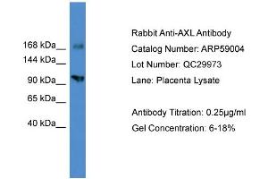 WB Suggested Anti-AXL  Antibody Titration: 0.